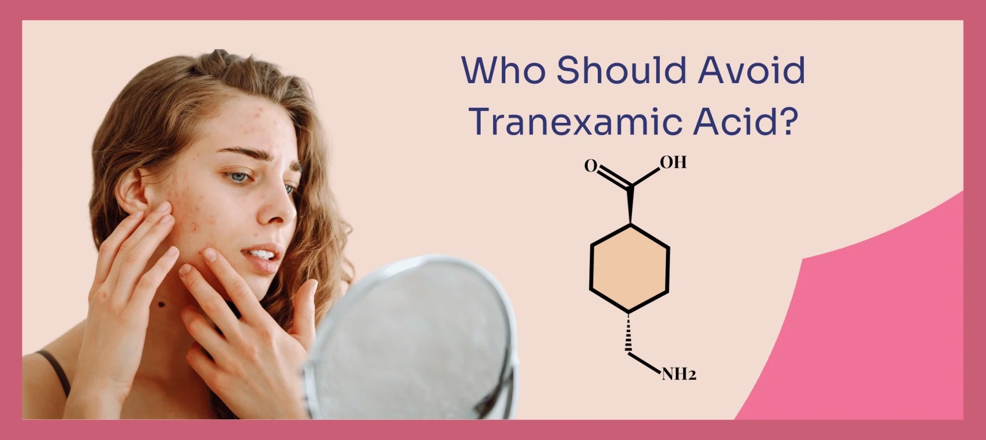 网红“氨甲环酸”被批准用于色斑治疗了吗？